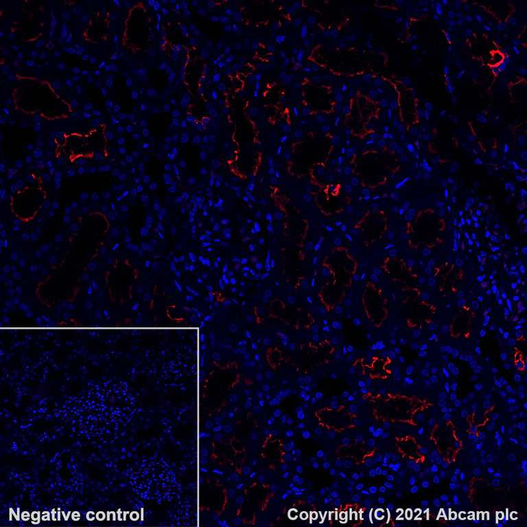 Immunohistochemistry (Formalin/PFA-fixed paraffin-embedded sections) - Alexa Fluor® 647 Anti-ACE2 antibody [EPR24705-45] (AB283658)