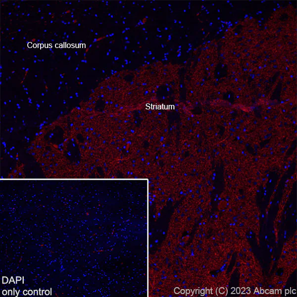Immunohistochemistry (Frozen sections) - Alexa Fluor® 647 Anti-Acetylcholinesterase antibody [EPR18978] (AB309246)