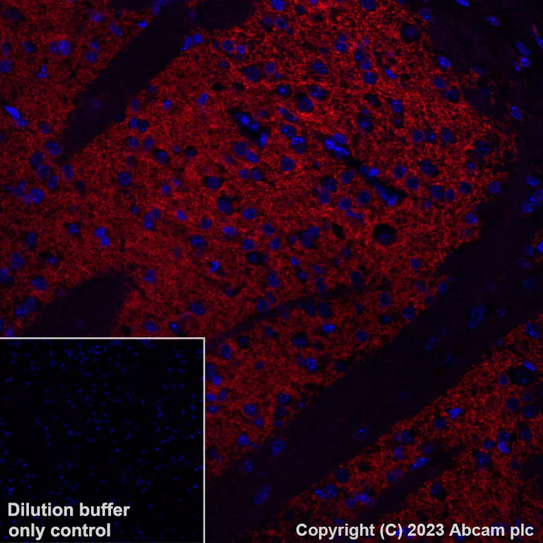 Immunohistochemistry (Formalin/PFA-fixed paraffin-embedded sections) - Alexa Fluor® 647 Anti-Adenosine Receptor A2a antibody [EPR23731-50] (AB308533)