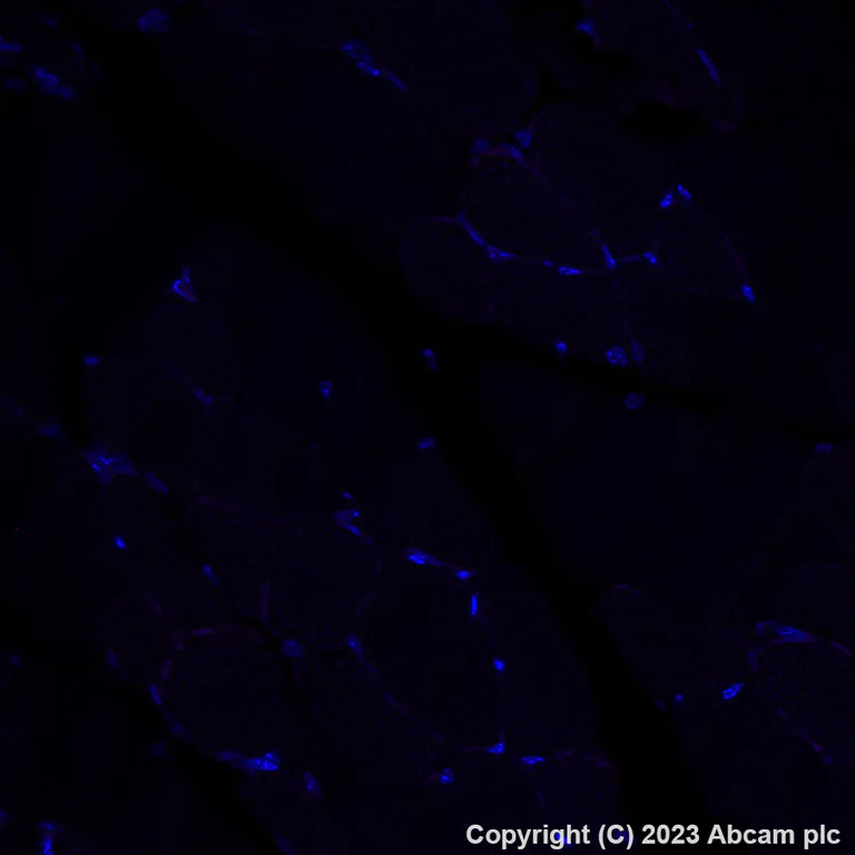 Immunohistochemistry (Formalin/PFA-fixed paraffin-embedded sections) - Alexa Fluor® 647 Anti-Adenosine Receptor A2a antibody [EPR23731-50] (AB308533)