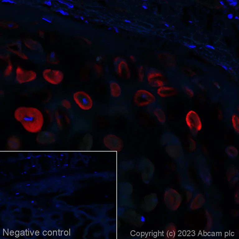 Immunohistochemistry (Formalin/PFA-fixed paraffin-embedded sections) - Alexa Fluor® 647 Anti-Aggrecan antibody [6-B-4] (AB315140)