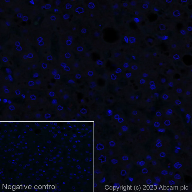 Immunohistochemistry (Formalin/PFA-fixed paraffin-embedded sections) - Alexa Fluor® 647 Anti-Aggrecan antibody [6-B-4] (AB315140)
