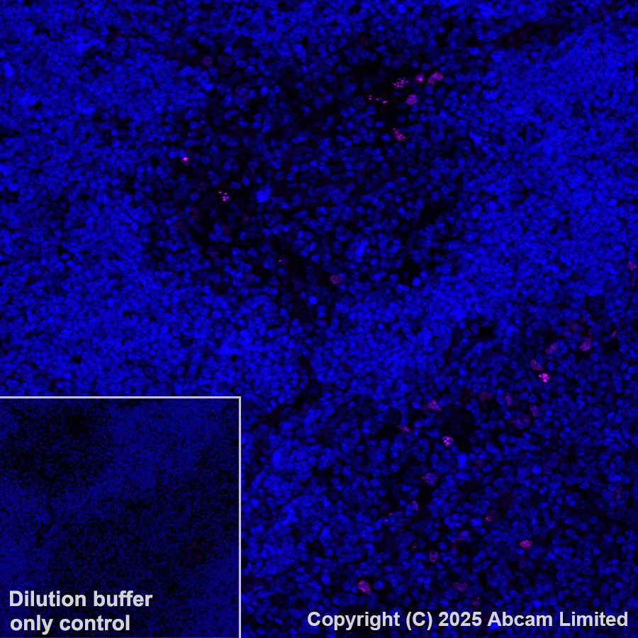 Immunohistochemistry (Formalin/PFA-fixed paraffin-embedded sections) - Alexa Fluor® 647 Anti-AIRE antibody [EPR28045-139] (AB323499), expandable thumbnail