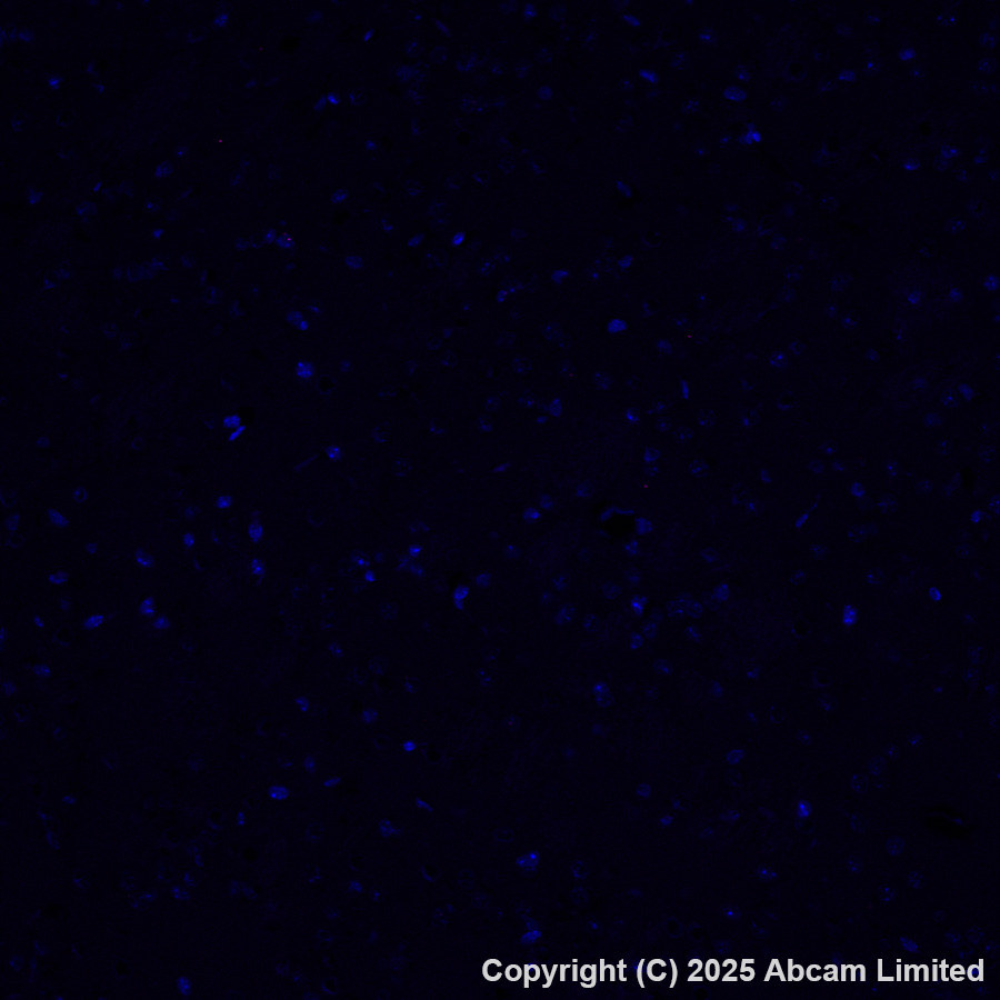 Immunohistochemistry (Formalin/PFA-fixed paraffin-embedded sections) - Alexa Fluor® 647 Anti-AIRE antibody [EPR28045-139] (AB323499), expandable thumbnail