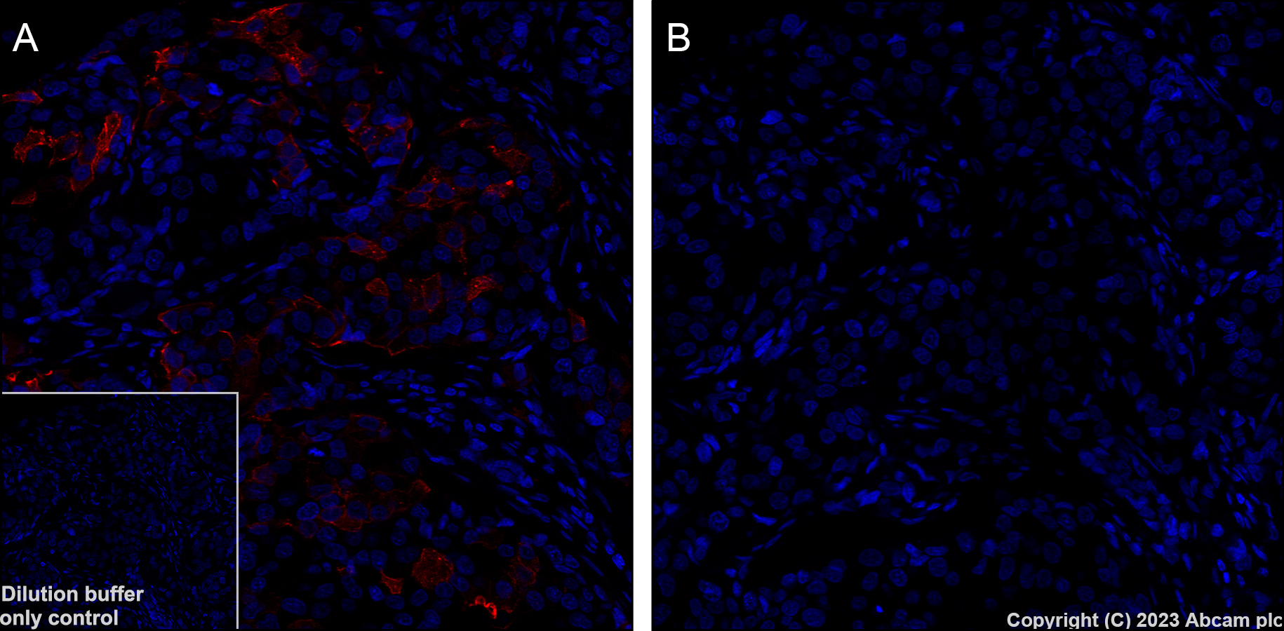 Immunohistochemistry (Formalin/PFA-fixed paraffin-embedded sections) - Alexa Fluor® 647 Anti-AKT1 (phospho S473) antibody [EP2109Y] (AB313670), expandable thumbnail