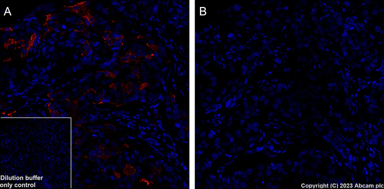 Immunohistochemistry (Formalin/PFA-fixed paraffin-embedded sections) - Alexa Fluor® 647 Anti-AKT1 (phospho S473) antibody [EP2109Y] (AB313670)