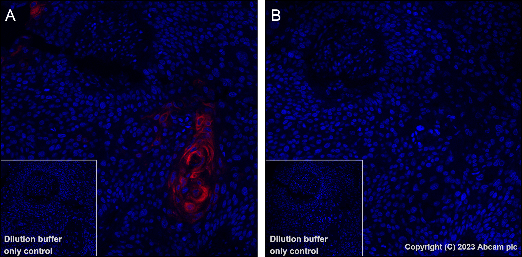 Immunohistochemistry (Formalin/PFA-fixed paraffin-embedded sections) - Alexa Fluor® 647 Anti-AKT1 (phospho S473) antibody [EP2109Y] (AB313670), expandable thumbnail
