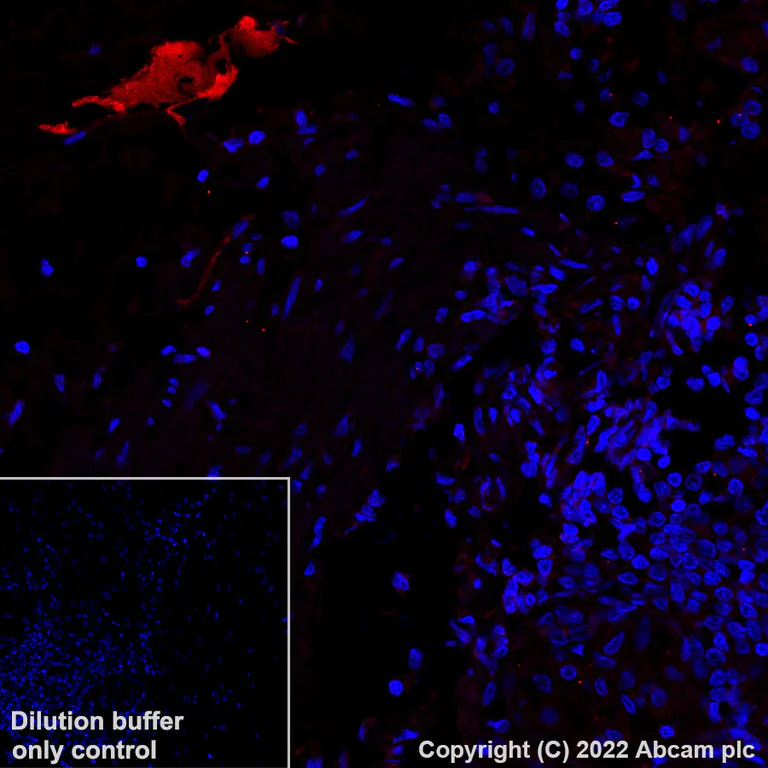 Immunohistochemistry (Formalin/PFA-fixed paraffin-embedded sections) - Alexa Fluor® 647 Anti-Albumin antibody [EPR12774] (AB307850)