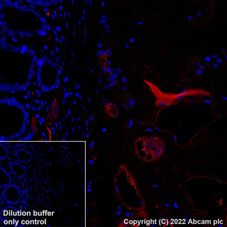 Immunohistochemistry (Formalin/PFA-fixed paraffin-embedded sections) - Alexa Fluor® 647 Anti-Albumin antibody [EPR12774] (AB307850)