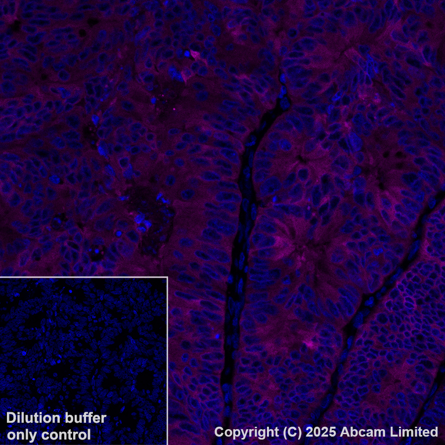 Immunohistochemistry (Formalin/PFA-fixed paraffin-embedded sections) - Alexa Fluor® 647 Anti-ALDH1A1 antibody [EP1933Y] (AB195255)