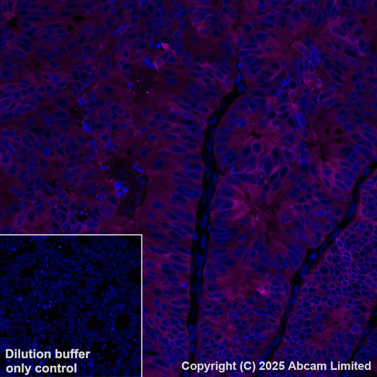 Immunohistochemistry (Formalin/PFA-fixed paraffin-embedded sections) - Alexa Fluor® 647 Anti-ALDH1A1 antibody [EP1933Y] (AB195255)
