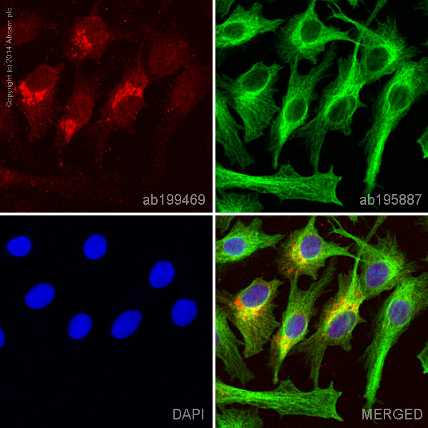Immunocytochemistry/ Immunofluorescence - Alexa Fluor® 647 Anti-alpha 1 Fetoprotein antibody [EPAFP61] (AB199469)