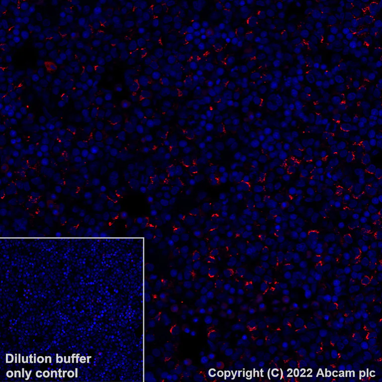 Immunohistochemistry (Formalin/PFA-fixed paraffin-embedded sections) - Alexa Fluor® 647 Anti-alpha 1 Fetoprotein antibody [EPR26548-19] (AB307862)