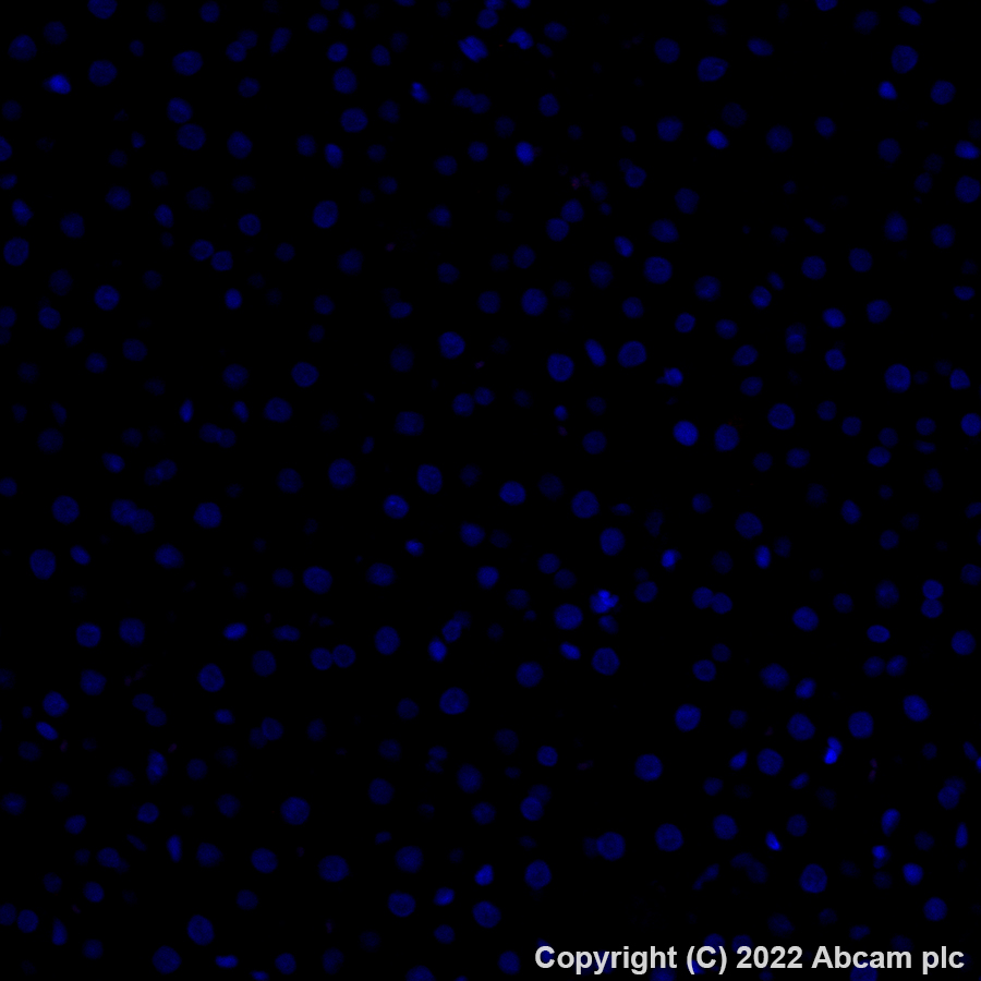 Immunohistochemistry (Formalin/PFA-fixed paraffin-embedded sections) - Alexa Fluor® 647 Anti-alpha 1 Fetoprotein antibody [EPR26548-19] (AB307862)