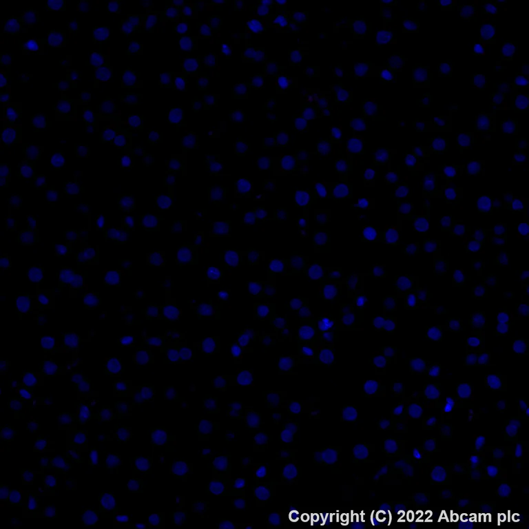 Immunohistochemistry (Formalin/PFA-fixed paraffin-embedded sections) - Alexa Fluor® 647 Anti-alpha 1 Fetoprotein antibody [EPR26548-19] (AB307862)