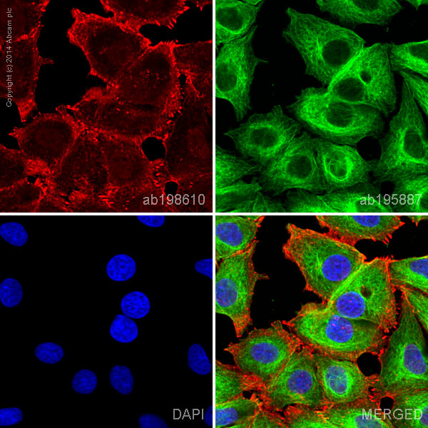 Immunocytochemistry/ Immunofluorescence - Alexa Fluor® 647 Anti-alpha Actinin 4 antibody [EPR2533(2)] - Cytoskeleton Marker (AB198610), expandable thumbnail