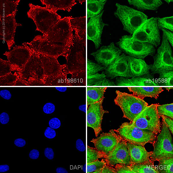 Immunocytochemistry/ Immunofluorescence - Alexa Fluor® 647 Anti-alpha Actinin 4 antibody [EPR2533(2)] - Cytoskeleton Marker (AB198610)