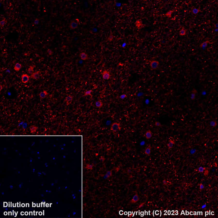 Immunohistochemistry (Formalin/PFA-fixed paraffin-embedded sections) - Alexa Fluor® 647 Anti-Alpha B Crystallin antibody [EPR2752] (AB314931), expandable thumbnail