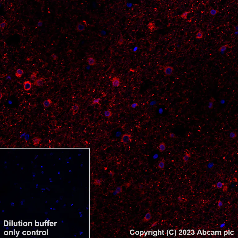 Immunohistochemistry (Formalin/PFA-fixed paraffin-embedded sections) - Alexa Fluor® 647 Anti-Alpha B Crystallin antibody [EPR2752] (AB314931)
