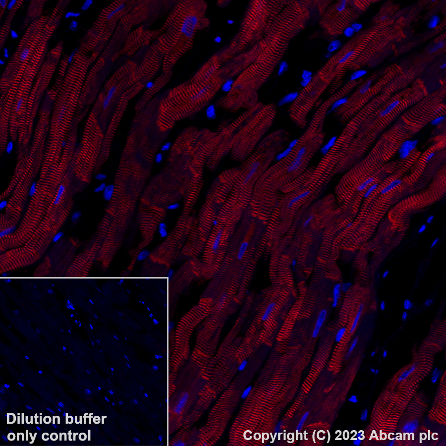 Immunohistochemistry (Formalin/PFA-fixed paraffin-embedded sections) - Alexa Fluor® 647 Anti-Alpha B Crystallin antibody [EPR2752] (AB314931), expandable thumbnail