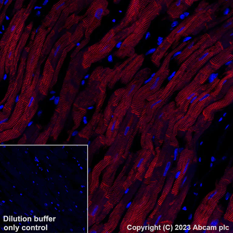 Immunohistochemistry (Formalin/PFA-fixed paraffin-embedded sections) - Alexa Fluor® 647 Anti-Alpha B Crystallin antibody [EPR2752] (AB314931)