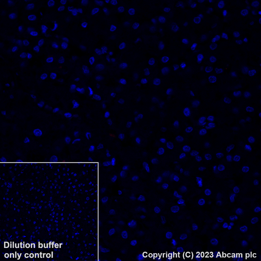 Immunohistochemistry (Formalin/PFA-fixed paraffin-embedded sections) - Alexa Fluor® 647 Anti-Alpha B Crystallin antibody [EPR2752] (AB314931), expandable thumbnail