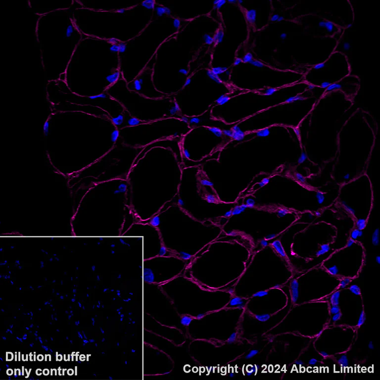 Immunohistochemistry (Formalin/PFA-fixed paraffin-embedded sections) - Alexa Fluor® 647 Anti-alpha Sarcoglycan antibody [EPR14773] (AB320777)