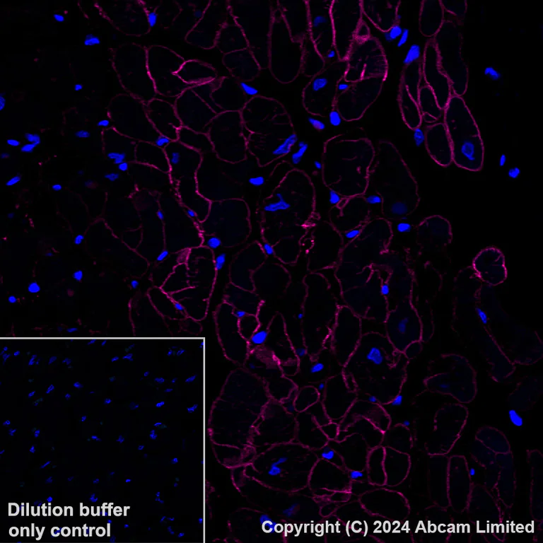 Immunohistochemistry (Formalin/PFA-fixed paraffin-embedded sections) - Alexa Fluor® 647 Anti-alpha Sarcoglycan antibody [EPR14773] (AB320777)