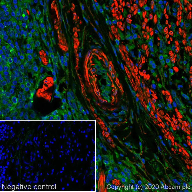 Immunohistochemistry (Formalin/PFA-fixed paraffin-embedded sections) - Alexa Fluor® 647 Anti-alpha smooth muscle Actin antibody [SP171] (AB267537)
