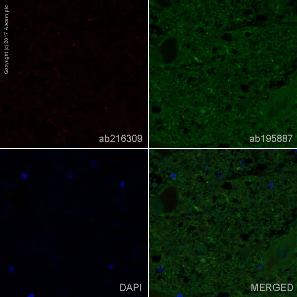 Immunohistochemistry (Formalin/PFA-fixed paraffin-embedded sections) - Alexa Fluor® 647 Anti-Alpha-synuclein aggregate antibody [MJFR-14-6-4-2] - Conformation-Specific (AB216309)