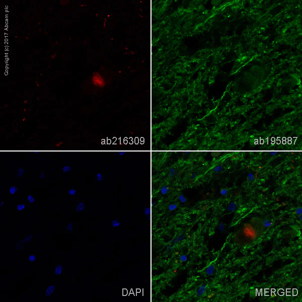 Immunohistochemistry (Formalin/PFA-fixed paraffin-embedded sections) - Alexa Fluor® 647 Anti-Alpha-synuclein aggregate antibody [MJFR-14-6-4-2] - Conformation-Specific (AB216309)