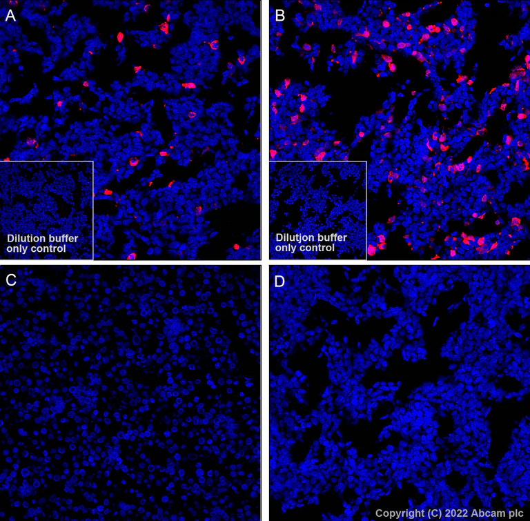 Immunohistochemistry (Formalin/PFA-fixed paraffin-embedded sections) - Alexa Fluor® 647 Anti-Alpha-synuclein, isoform 98 and 112 antibody [EPR25115-65] (AB307612)