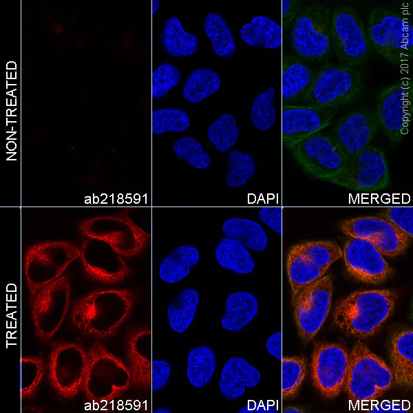 Immunocytochemistry/ Immunofluorescence - Alexa Fluor® 647 Anti-alpha Tubulin (acetyl K40) antibody [EPR16772] (AB218591)