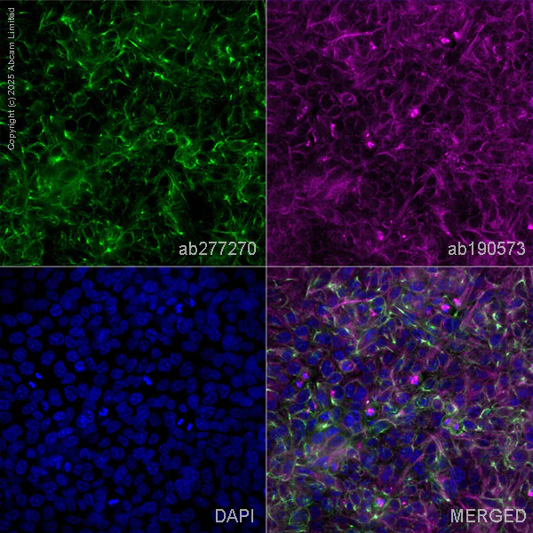Immunocytochemistry - Alexa Fluor® 647 Anti-alpha Tubulin antibody [EP1332Y] - Microtubule Marker (AB190573)