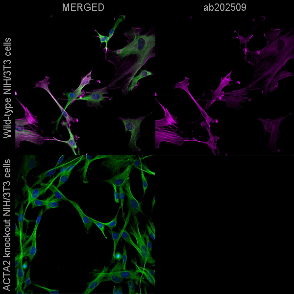 Immunocytochemistry - Alexa Fluor® 647 Anti-alpha Tubulin antibody [EP1332Y] - Microtubule Marker (AB190573), expandable thumbnail