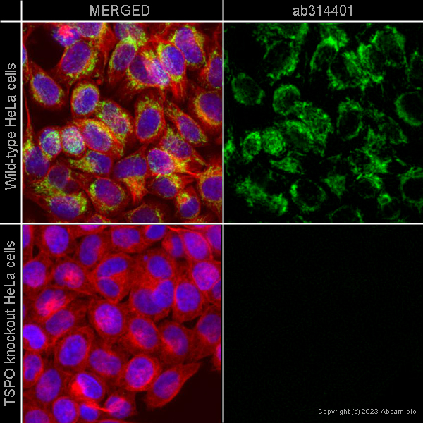 Immunocytochemistry/ Immunofluorescence - Alexa Fluor® 647 Anti-alpha Tubulin antibody [EP1332Y] - Microtubule Marker (ab190573), expandable thumbnail