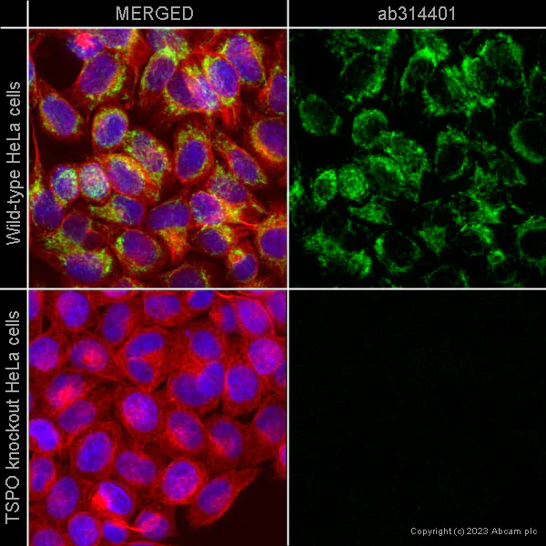 Immunocytochemistry/ Immunofluorescence - Alexa Fluor® 647 Anti-alpha Tubulin antibody [EP1332Y] - Microtubule Marker (AB190573)