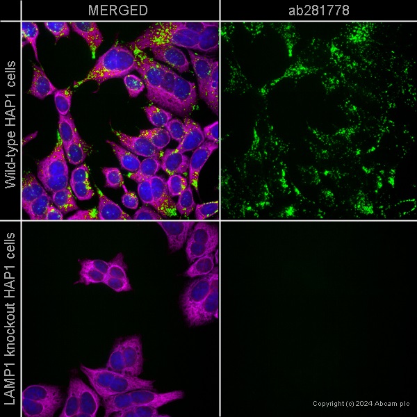 Immunocytochemistry/ Immunofluorescence - Alexa Fluor® 647 Anti-alpha Tubulin antibody [EP1332Y] - Microtubule Marker (ab190573), expandable thumbnail