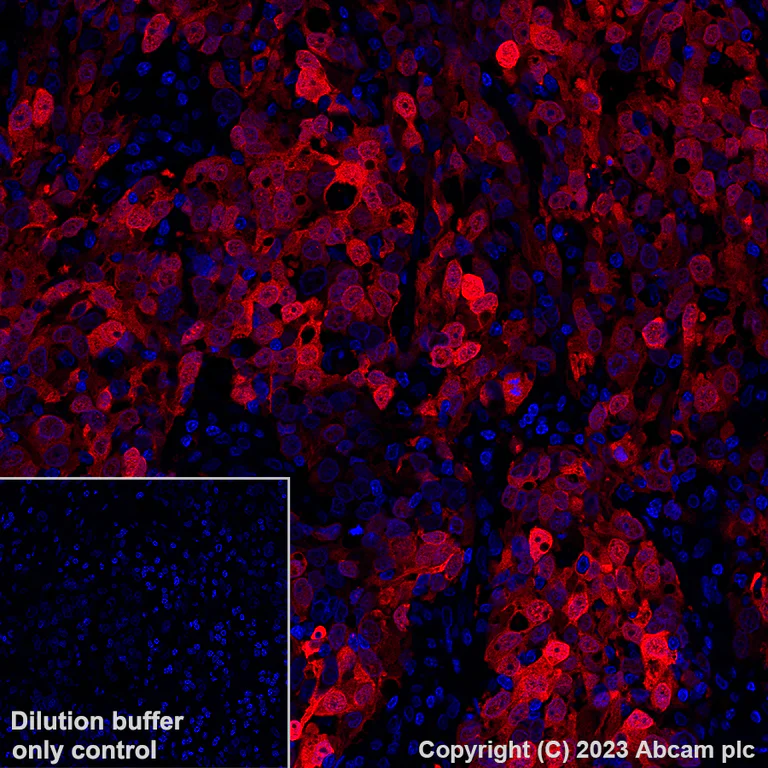 Immunohistochemistry (Formalin/PFA-fixed paraffin-embedded sections) - Alexa Fluor® 647 Anti-Annexin A1/ANXA1 antibody [EPR19342] (AB309365)