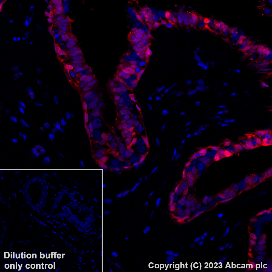 Immunohistochemistry (Formalin/PFA-fixed paraffin-embedded sections) - Alexa Fluor® 647 Anti-Annexin A1/ANXA1 antibody [EPR19342] (AB309365), expandable thumbnail