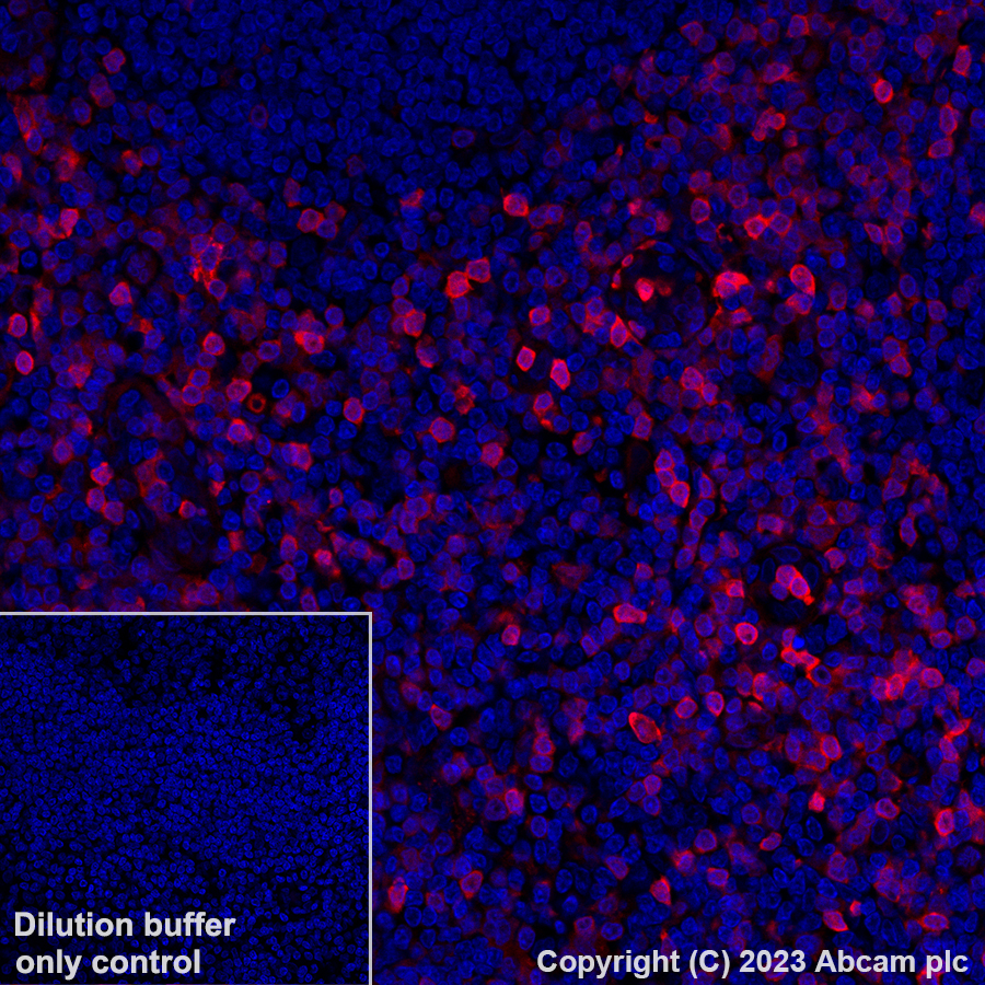Immunohistochemistry (Formalin/PFA-fixed paraffin-embedded sections) - Alexa Fluor® 647 Anti-Annexin A1/ANXA1 antibody [EPR19342] (AB309365), expandable thumbnail
