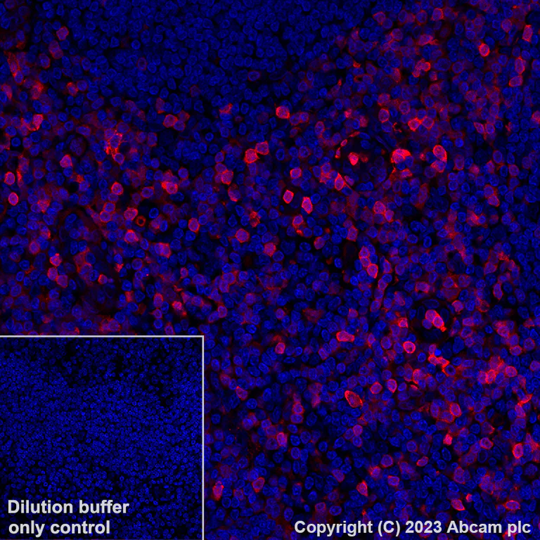 Immunohistochemistry (Formalin/PFA-fixed paraffin-embedded sections) - Alexa Fluor® 647 Anti-Annexin A1/ANXA1 antibody [EPR19342] (AB309365)