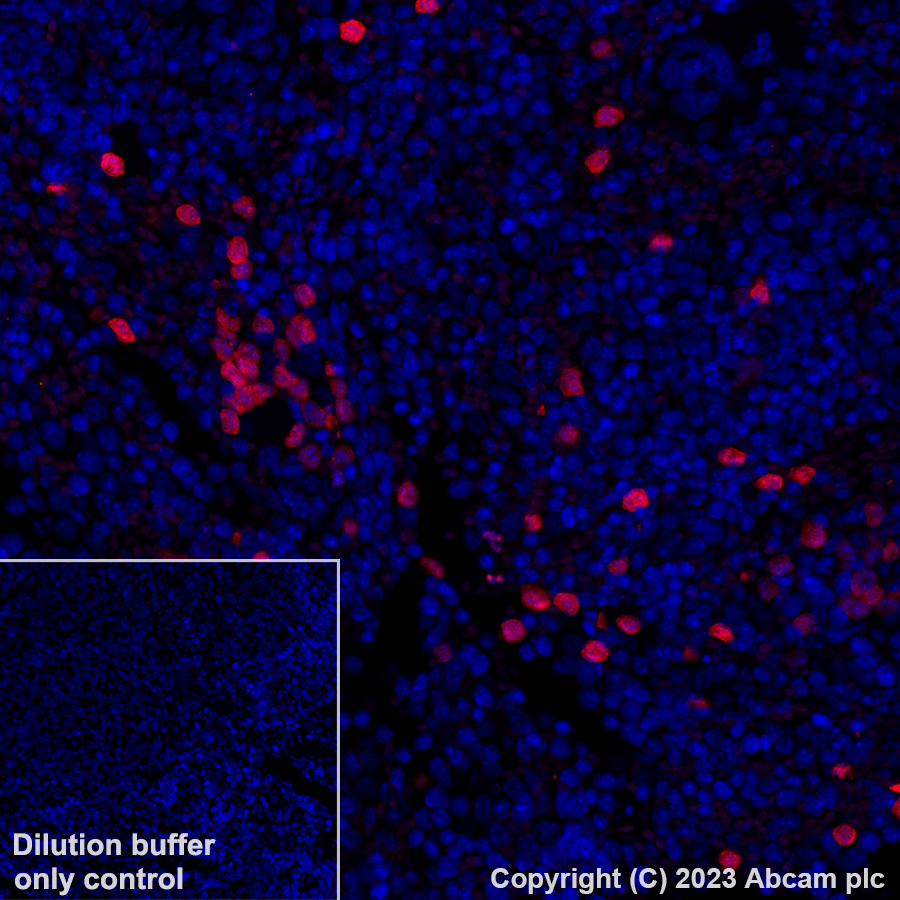 Immunohistochemistry (Formalin/PFA-fixed paraffin-embedded sections) - Alexa Fluor® 647 Anti-Annexin A1/ANXA1 antibody [EPR19342] (AB309365), expandable thumbnail