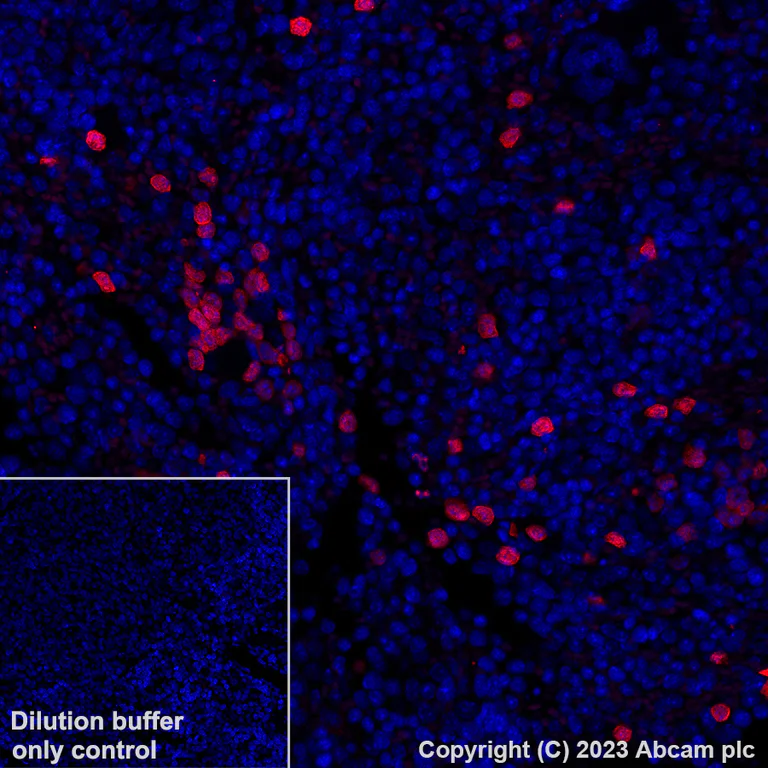 Immunohistochemistry (Formalin/PFA-fixed paraffin-embedded sections) - Alexa Fluor® 647 Anti-Annexin A1/ANXA1 antibody [EPR19342] (AB309365)