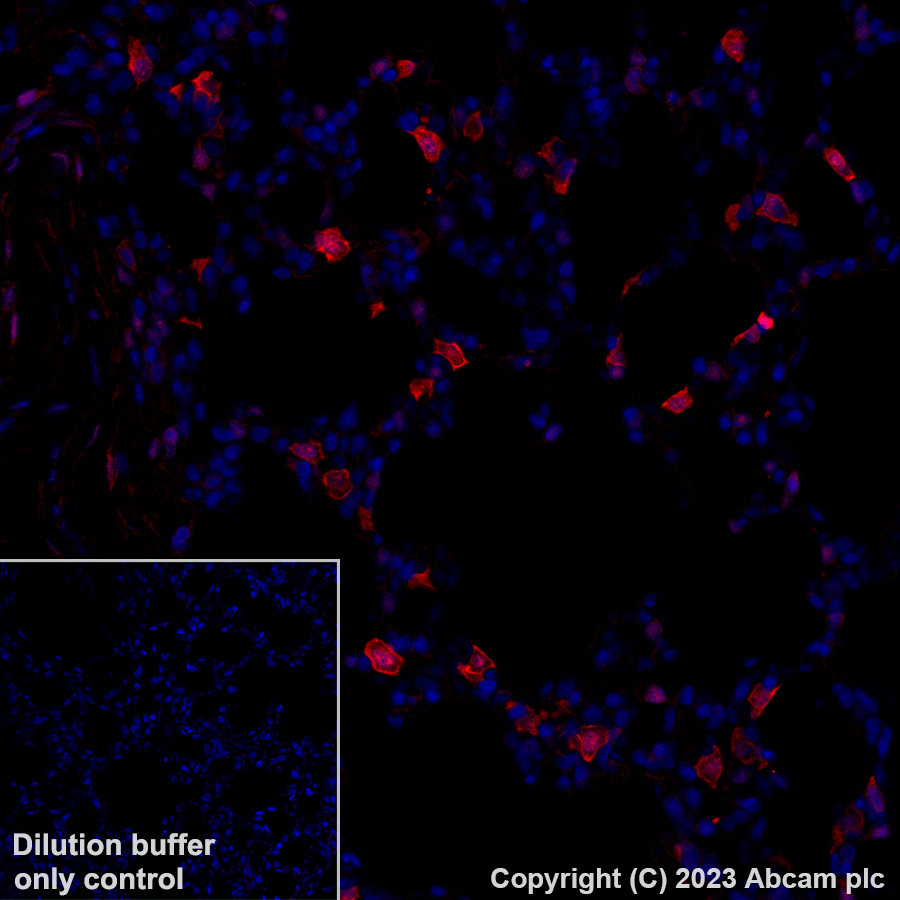 Immunohistochemistry (Formalin/PFA-fixed paraffin-embedded sections) - Alexa Fluor® 647 Anti-Annexin A1/ANXA1 antibody [EPR19342] (AB309365), expandable thumbnail