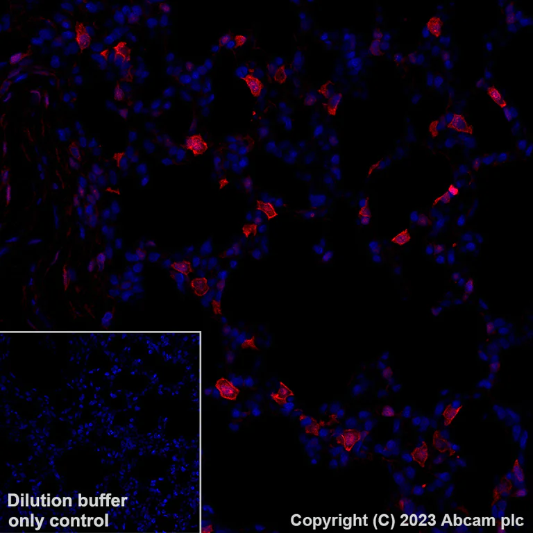 Immunohistochemistry (Formalin/PFA-fixed paraffin-embedded sections) - Alexa Fluor® 647 Anti-Annexin A1/ANXA1 antibody [EPR19342] (AB309365)