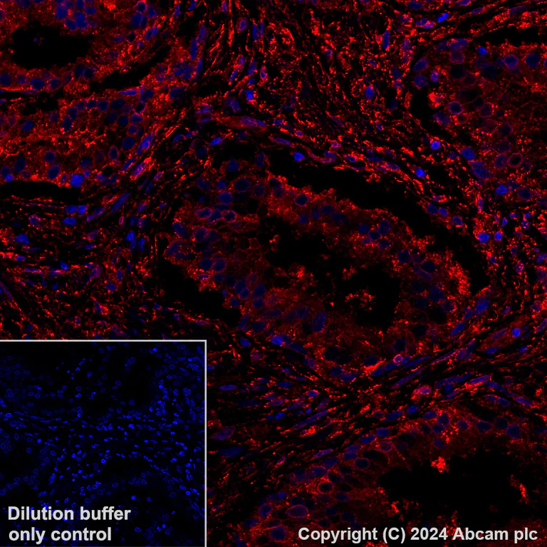 Immunohistochemistry (Formalin/PFA-fixed paraffin-embedded sections) - Alexa Fluor® 647 Anti-Annexin V/ANXA5 antibody [EPR28047-61] (AB318176)