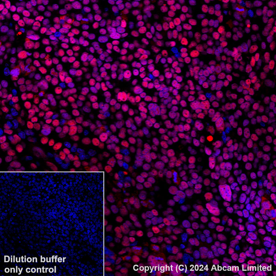 Immunohistochemistry (Formalin/PFA-fixed paraffin-embedded sections) - Alexa Fluor® 647 Anti-APE1 antibody [EPR18378-45] (AB319078), expandable thumbnail