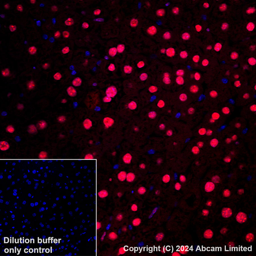 Immunohistochemistry (Formalin/PFA-fixed paraffin-embedded sections) - Alexa Fluor® 647 Anti-APE1 antibody [EPR18378-45] (AB319078), expandable thumbnail