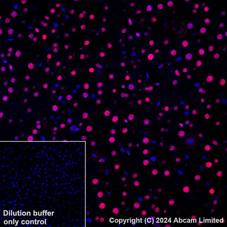Immunohistochemistry (Formalin/PFA-fixed paraffin-embedded sections) - Alexa Fluor® 647 Anti-APE1 antibody [EPR18378-45] (AB319078)